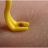 Pour enlever une tique fixée sur la peau, il est recommandé d'utiliser un tire-tique, vendu en pharmacie. Otom/Wikimedia, CC BY-SA, https://commons.wikimedia.org/w/index.php?curid=6647041
